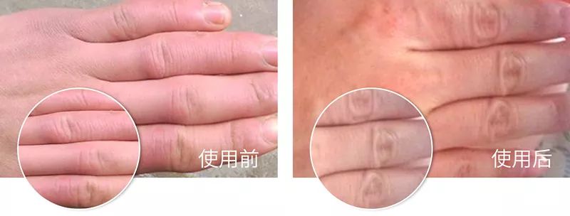 凤凰网梧桐汇商城|皮肤干痒、开裂、脱皮?用它抹一抹,立马见效