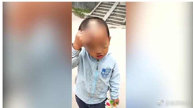 深圳2男童脸上有伤疑似被虐待 街道办：系失管失教