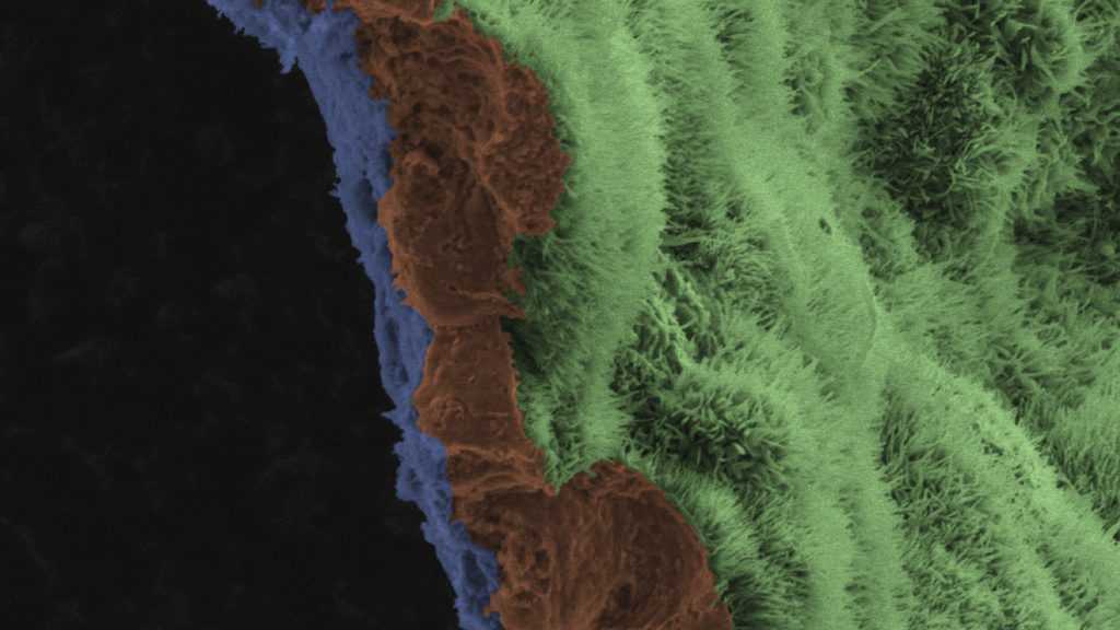 诺贝尔奖干细胞技术首次人体试验 关注黄斑变性