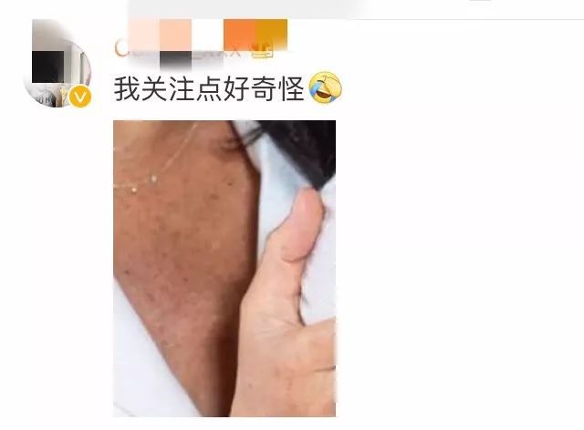 梅根产后肚子骇人，Ella产后子宫、膀胱脱落、尿失禁：那些催生者不会告诉你的事