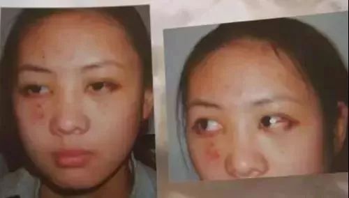 被“男友”暴打？和老师恋爱？终于红了的她究竟遭遇过什么…