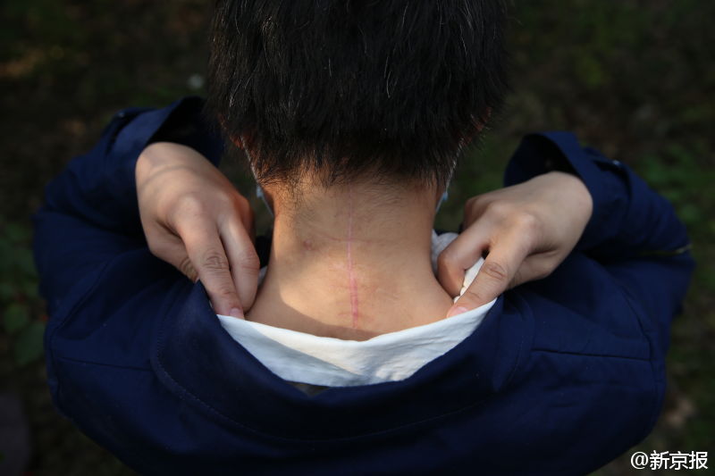 老虎伤人事件伤者: 后悔没立刻发声 将提起诉讼