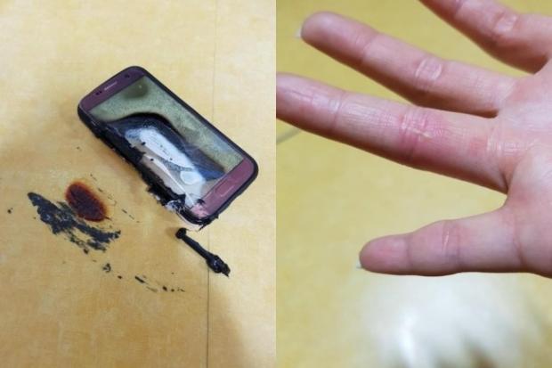 韩国一用户的三星Galaxy S7在充电时着火造成伤害