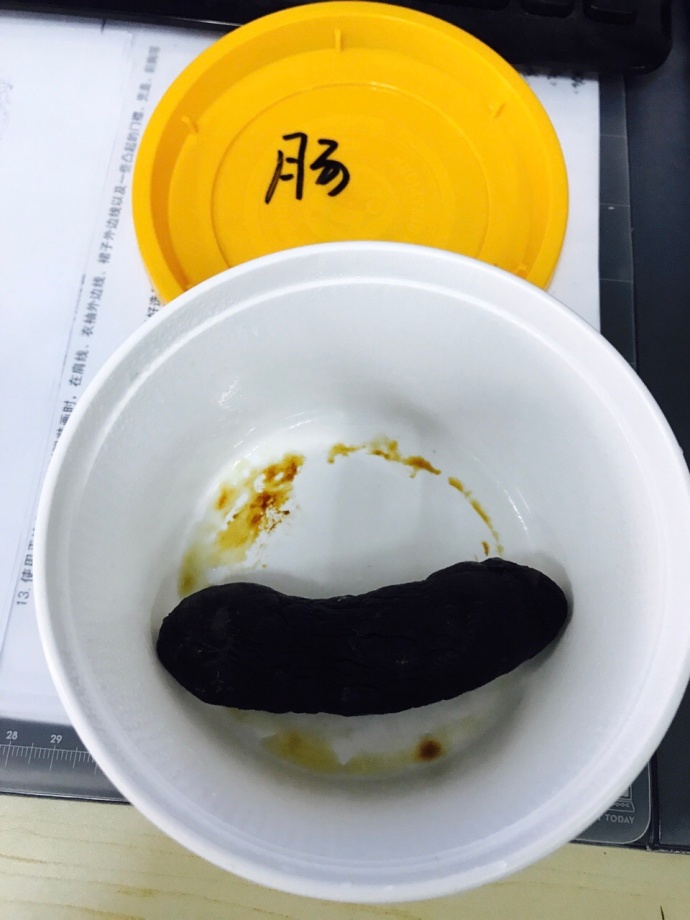 fun来了:夫妻相是接吻造成的 证明丑是会传染的 fun来了:夫妻相是接吻造成的 证明丑是会传染的图片