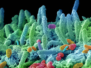 法媒:头皮屑并非由真菌引起 细菌才是罪魁祸首