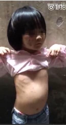 　　被打女孩
