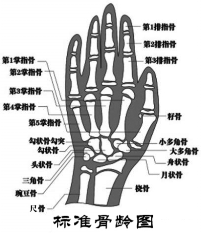 中国人手腕骨发育标准_chn法