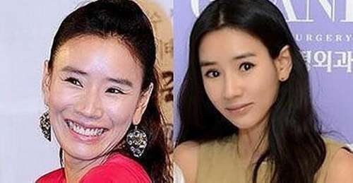 她们是韩国人眼里整容最多的女星 前后差异大