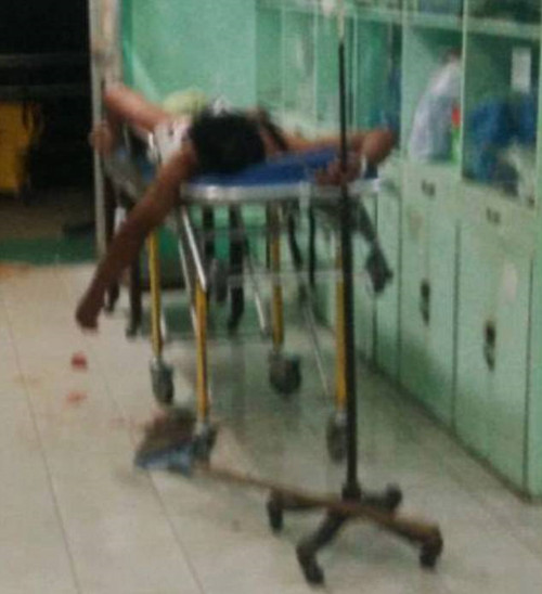 遭妻子袭击的男子马克躺在医院的担架上。