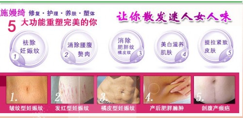 生长纹怎么去除