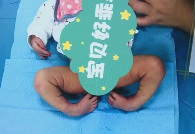 二胎宝宝刚出生，父母看了眼他的脚，顿时吓傻了！