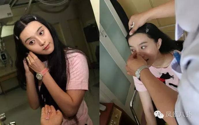 从张歆艺的下巴褶皱说起，女明星的下巴到底藏了什么秘密？