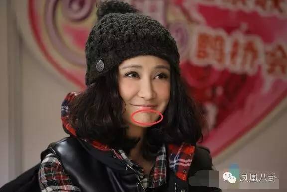 从张歆艺的下巴褶皱说起，女明星的下巴到底藏了什么秘密？