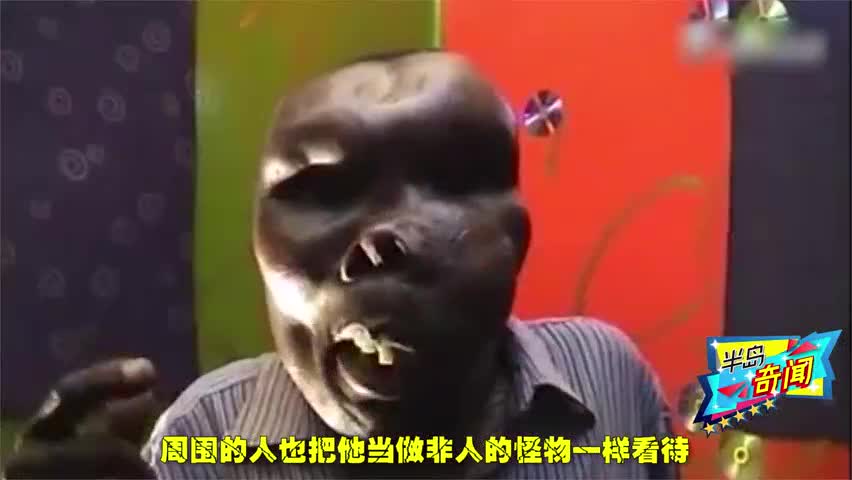 世界上最丑的男人已经娶了2个妻子生了8个娃,成为当红