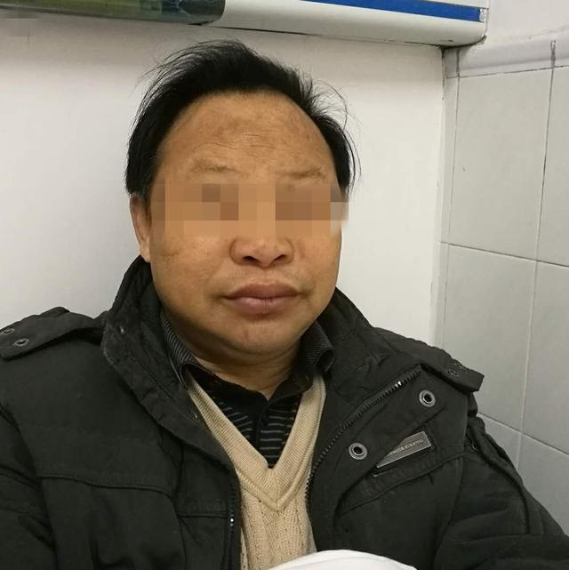 检查发现,其甲状腺功能t3,t4已经低到检验科无法检查出来,同时心,肝