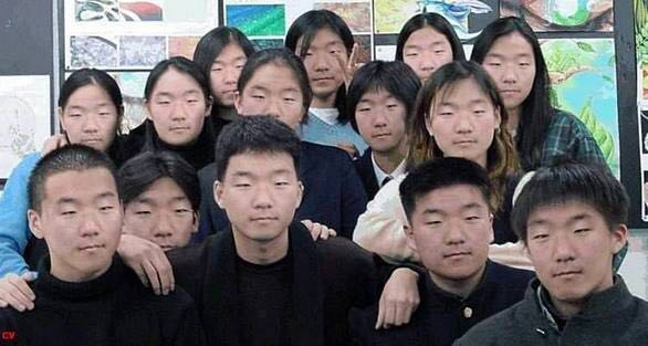 为什么脸盲症会认不清人脸?