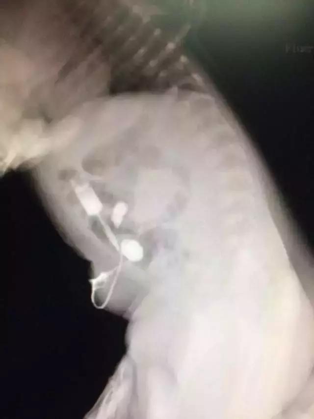 福州专家:惊呆了!肚脐还有这个“特异功能”