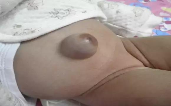 福州专家:惊呆了!肚脐还有这个“特异功能”