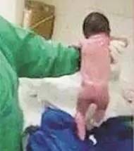 婴儿刚出生就会“行走”视频网络爆红 医生释疑