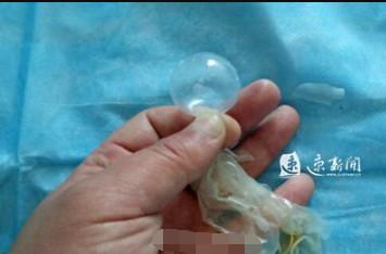 女子为哄孩子，用避孕套吸小球，将自己“炸”进医院！