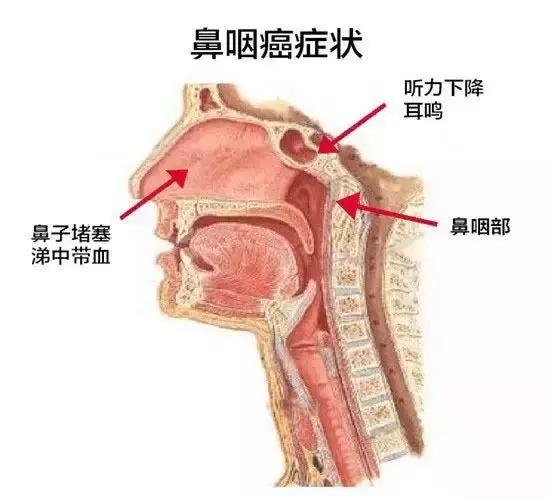 男神金宇彬患鼻咽癌，这个病在中国很高发！拿什么来守护你的生命健康？
