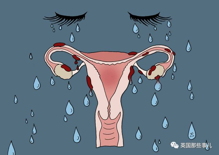 姨妈痛，忍忍就过去了??三个妹纸的故事，有时候姨妈疼还真没那么简单啊!_凤凰资讯