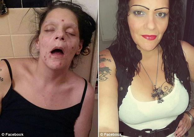 女子分享自己吸毒前后的对比照片，鼓励吸毒者勇敢戒毒