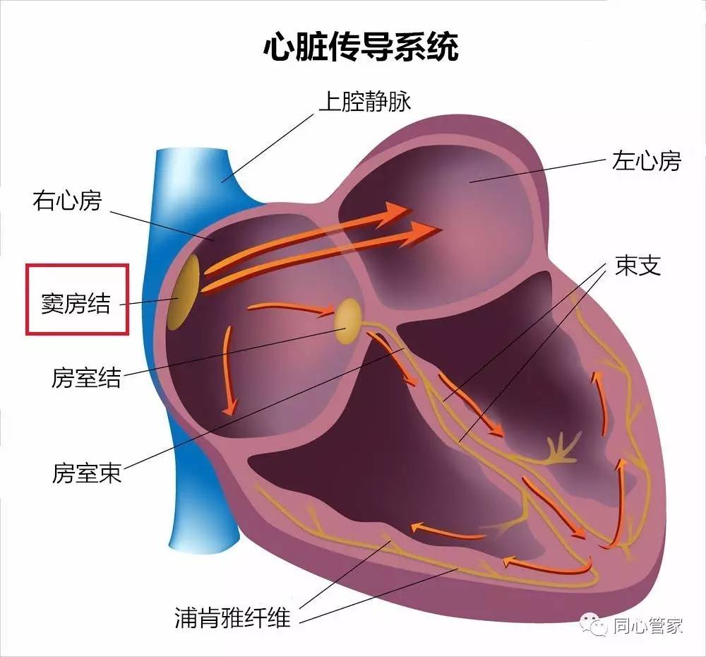 正文 心脏传导系统 人体正常的心跳就是从窦房结发出的,是"心脏起搏点