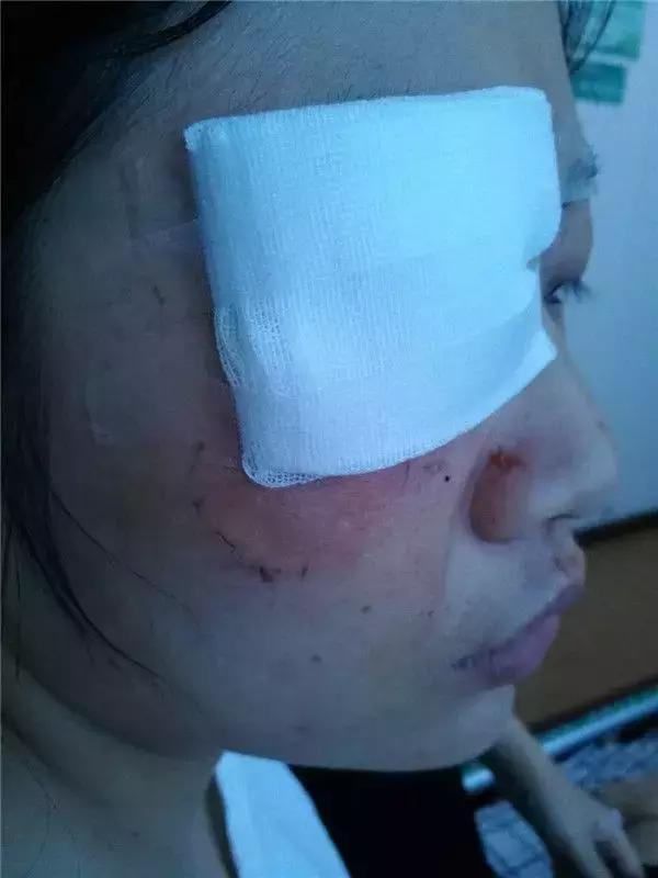 输液滴壶有空气？患者家属殴打护士致其缝7针！