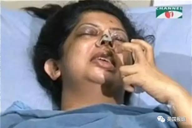 孟加拉女教授被丈夫挖掉双眼咬掉鼻尖,只因她不是文盲