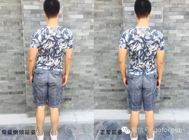 「侧倾」即骨盆向侧面倾斜.