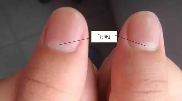看指甲,就能知道有没有生病?