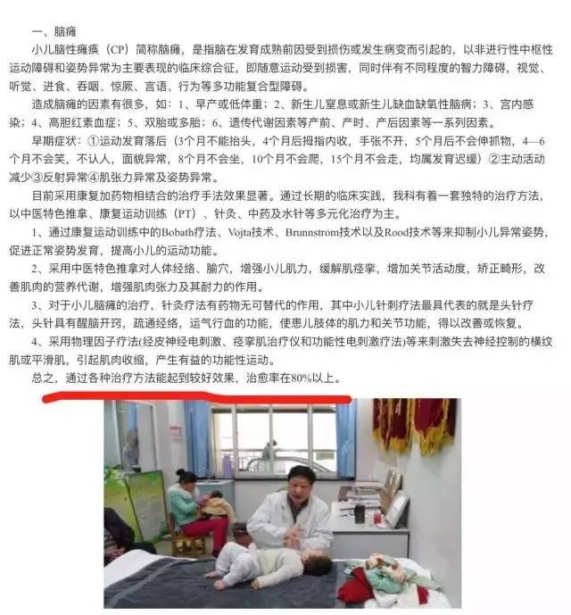 脑瘫总人口_脑瘫儿图片(3)