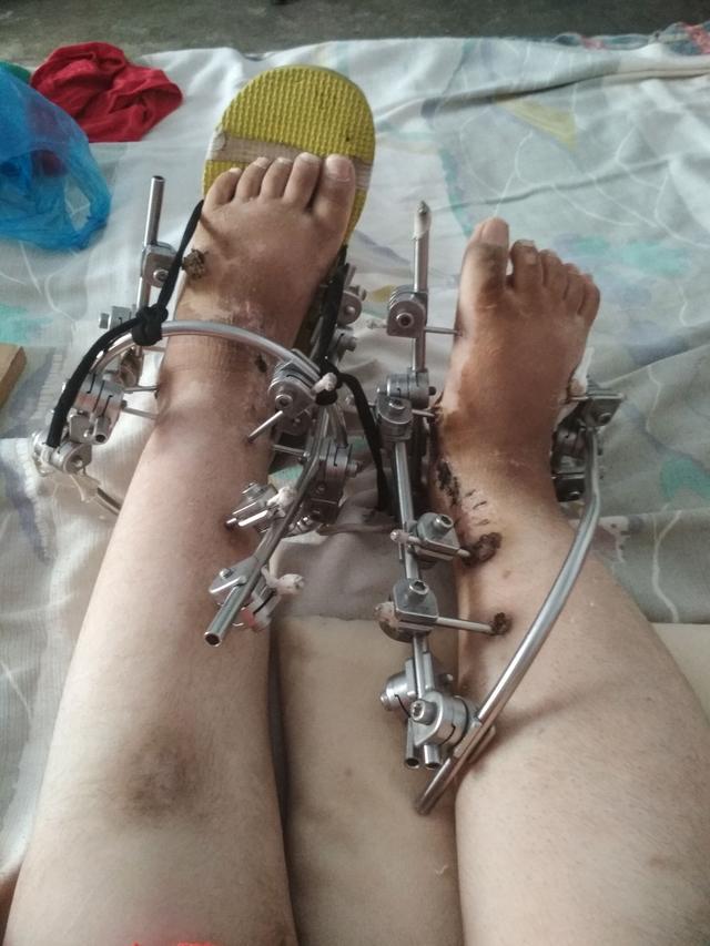 因女儿先天残疾 母女俩被丈夫打出家门