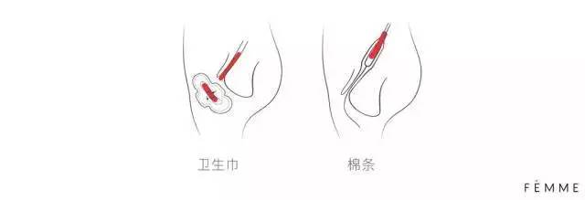 棉条怎么用?任何人群都能用?| 史上超走心的卫