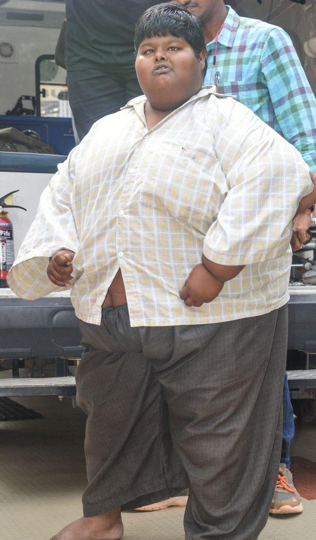 印度男孩胖的前胸后背都长满了下垂的乳房,终于下决心