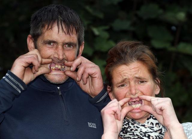 英国夫妻4年无处治牙，喝自制麻药忍痛自己拔牙