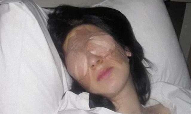 女子患怪病13年发病时痉挛无法睁眼，医生也找不出病因