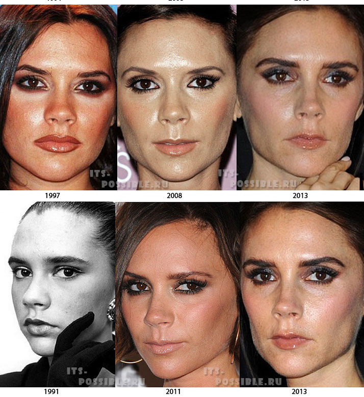 vicki_beckham_19912013-e1458896552505