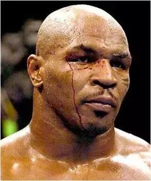 不可一世的泰森在监狱竟被暴打至头破血流!