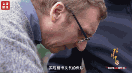 2岁男孩特重度烧伤危在旦夕 父母无力承担手术费