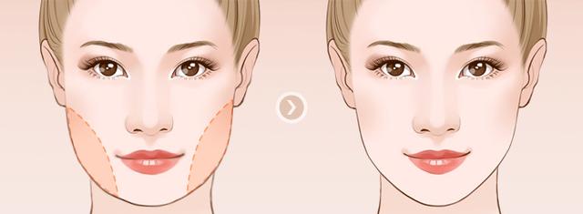 苹果肌下垂,法令纹加深70%的人都用错了方法