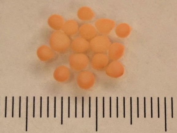 斯坦福实验室中培育的迷你大脑就像直径仅有几毫米的小 斯坦福实验室中培育的迷你大脑就像直径仅有几毫米的小