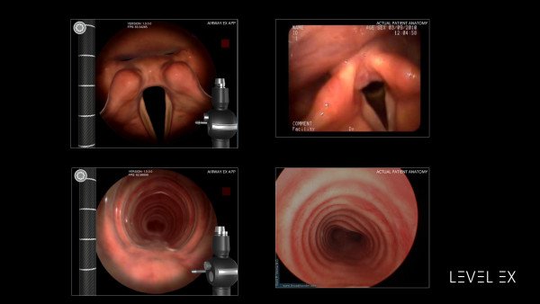 Level Ex 获千万融资，VR医疗已有建树 
