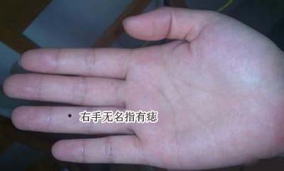 身上有这些痣,注定是奔波命,一生四处奔走,很难定居下来!
