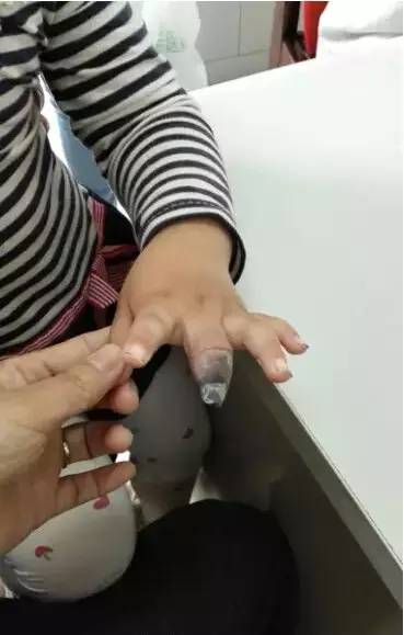 女童贴创可贴导致截肢 这几种用法都是错误的