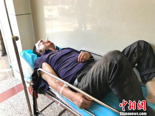 图为遭野象袭击的男子常宗波摄 图为遭野象袭击的男子常宗波摄