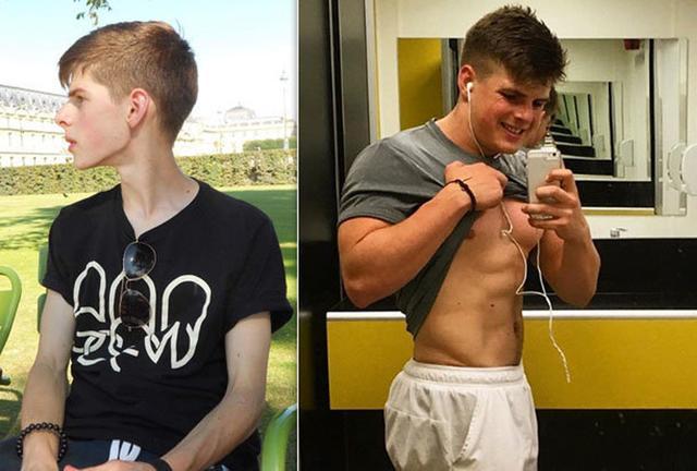 患饮食障碍男孩曾经只有89斤，现在满身肌肉壮如牛
