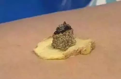 鸡蛋敷肚脐,一招让男人变强壮、女人貌美如花