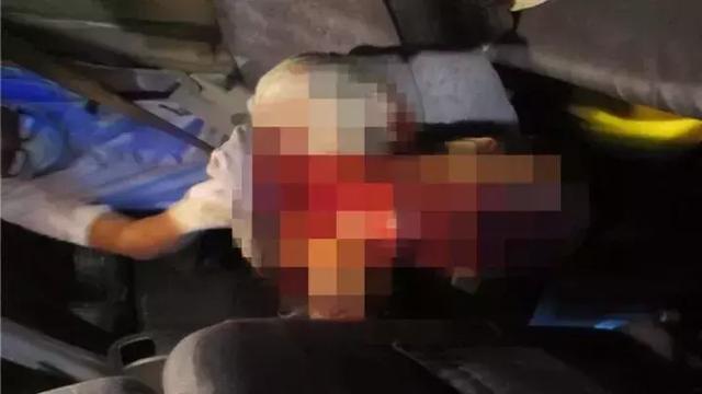 惊悚！男子深夜回家先是一声尖叫 接着喉咙被刺穿一个洞（图） - 5